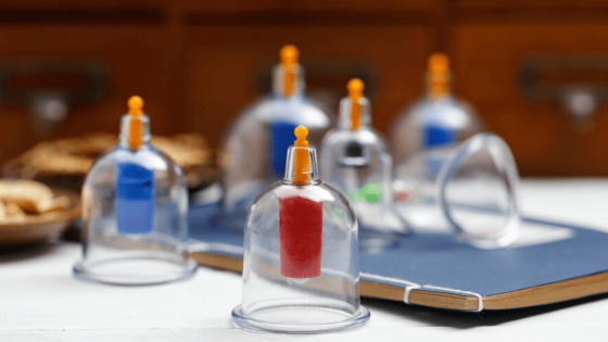 مراكز حجامة الرياض